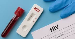 HIV test kit and blood sample